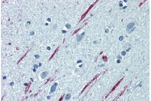 Human Brain, Cortex: Formalin-Fixed, Paraffin-Embedded (FFPE) (Spastin antibody  (AA 200-305))
