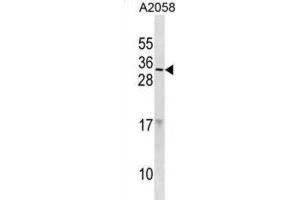 Western Blotting (WB) image for anti-Ribonuclease, RNase A Family, 9 (Non-Active) (RNASE9) antibody (ABIN3001184) (RNASE9 antibody)