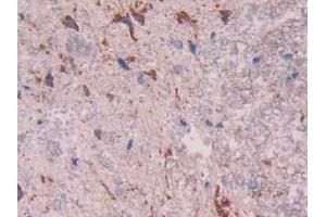 Immunohistochemistry (IHC) image for anti-Cathepsin D (CTSD) (AA 120-407) antibody (ABIN7438949)