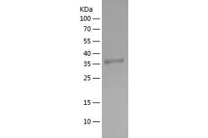 Western Blotting (WB) image for Proto-oncogene tyrosine-protein kinase Src (Src) (AA 1-79) protein (His-IF2DI Tag) (ABIN7281993) (Src Protein (AA 1-79) (His-IF2DI Tag))