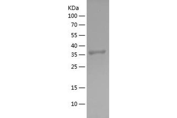Src Protein (AA 1-79) (His-IF2DI Tag)