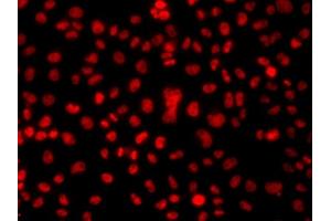 Immunofluorescence analysis of  cells using hnRNP  antibody (ABIN6128029, ABIN6141896, ABIN6141899 and ABIN6223388). (HNRNPA1 antibody  (AA 1-372))