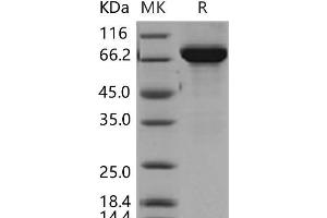 Thimet Oligopeptidase 1 Protein (THOP1) (His tag)