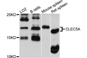 Western blot analysis of extracts of various cell lines, using CLEC5A antibody (ABIN5971486) at 1/1000 dilution.