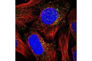 Immunofluorescent staining of human cell line U-2 OS with NSUN7 polyclonal antibody  at 1-4 ug/mL dilutions shows positivity in vesicles. (NSUN7 antibody)