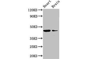 Western Blot Positive WB detected in: Mouse heart tissue, Mouse brain tissue All lanes: P2RX1 antibody at 3 μg/mL Secondary Goat polyclonal to rabbit IgG at 1/50000 dilution Predicted band size: 45 kDa Observed band size: 45 kDa (P2RX1 antibody  (AA 54-175))