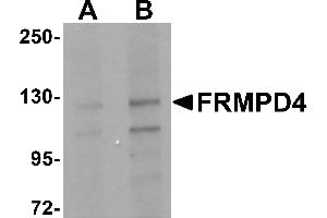 Western Blotting (WB) image for anti-FERM and PDZ Domain Containing 4 (FRMPD4) (Middle Region) antibody (ABIN1030935) (FRMPD4 antibody  (Middle Region))