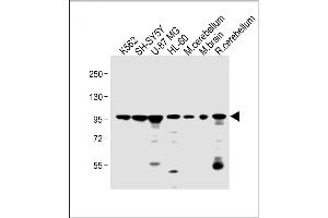 All lanes : Anti-DNAJC6 Antibody (Center) at 1:2000 dilution Lane 1: K562 whole cell lysate Lane 2: SH-SY5Y whole cell lysate Lane 3: U-87 MG whole cell lysate Lane 4: HL-60 whole cell lysate Lane 5: mouse cerebellum lysate Lane 6: mouse brain lysate Lane 7: rat cerebellum lysate Lysates/proteins at 20 μg per lane. (DNAJC6 antibody  (AA 254-281))