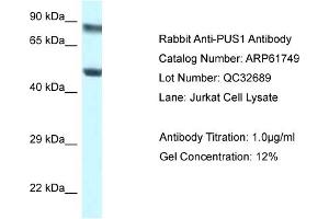 Western Blotting (WB) image for anti-Pseudouridylate Synthase 1 (PUS1) (N-Term) antibody (ABIN2788888) (PUS1 antibody  (N-Term))