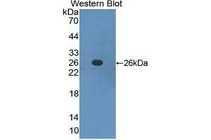 Western Blotting (WB) image for anti-Interferon alpha/beta Receptor 1 (IFNAR1) (AA 28-227) antibody (ABIN1859262) (IFNAR1 antibody  (AA 28-227))