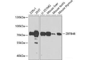 Western blot analysis of extracts of various cell lines using ZBTB48 Polyclonal Antibody at dilution of 1:1000. (ZBTB48 antibody)