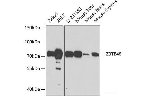 ZBTB48 anticorps