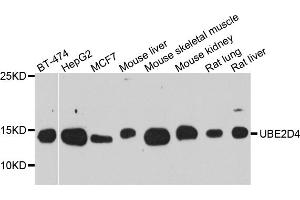 Western blot analysis of extracts of various cell lines, using UBE2D4 antibody (ABIN5974832) at 1/1000 dilution. (UBE2D4 antibody)
