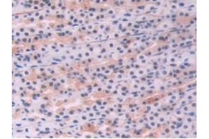 IHC-P analysis of Rat Stomach Tissue, with DAB staining. (Endoglin antibody  (AA 26-136))