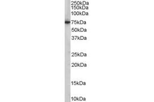 Western Blotting (WB) image for anti-phosphoenolpyruvate Carboxykinase 2 (Mitochondrial) (PEPCK) (Internal Region) antibody (ABIN2466080) (PEPCK antibody  (Internal Region))