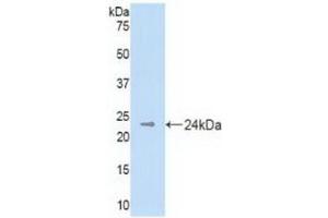 Detection of Recombinant DHH, Mouse using Polyclonal Antibody to Hedgehog Homolog, Desert (DHH) (desert Hedgehog antibody  (AA 212-392))