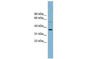 PLSCR3 antibody used at 1 ug/ml to detect target protein. (PLSCR3 antibody  (Middle Region))