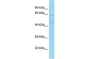 WB Suggested Anti-EBF4 Antibody Titration: 1.