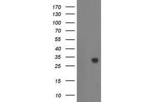 HEK293T cells were transfected with the pCMV6-ENTRY control (Left lane) or pCMV6-ENTRY ZFAND2B (Right lane) cDNA for 48 hrs and lysed. (ZFAND2B antibody)