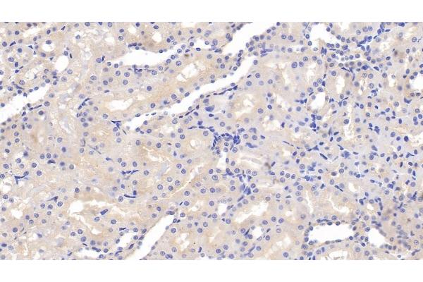 Permeability Glycoprotein antibody  (AA 999-1277)
