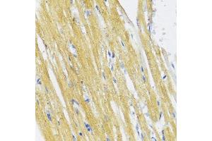 Immunohistochemistry of paraffin-embedded rat heart using IKBKE antibody. (IKKi/IKKe antibody  (AA 495-716))