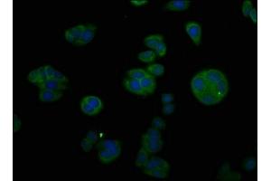 Immunofluorescent analysis of HepG2 cells using ABIN7148441 at dilution of 1:100 and Alexa Fluor 488-congugated AffiniPure Goat Anti-Rabbit IgG(H+L) (CTGF antibody  (AA 253-349))