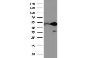 Western Blotting (WB) image for anti-T-Cell Acute Lymphocytic Leukemia 1 (TAL1) antibody (ABIN1501292) (TAL1 antibody)