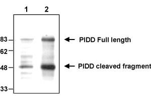 Western blot analysis of endogenous and overexpressed human PIDD using MAb to PIDD (Anto-1) . (PIDD antibody  (AA 776-910))