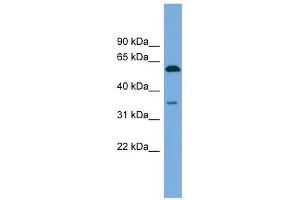 SAAL1 antibody used at 1 ug/ml to detect target protein. (SAAL1 antibody  (N-Term))