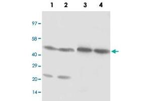 Western blot analysis of cell and tissue lysates with NR1H3 polyclonal antibody .