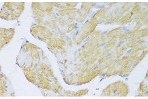 Immunohistochemistry of paraffin-embedded Rat heart using DENR Polyclonal Antibody at dilution of 1:150 (40x lens). (Density Regulated Protein antibody)