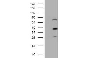 HEK293T cells were transfected with the pCMV6-ENTRY control (Left lane) or pCMV6-ENTRY DTNB (Right lane) cDNA for 48 hrs and lysed. (Dystrobrevin beta antibody)