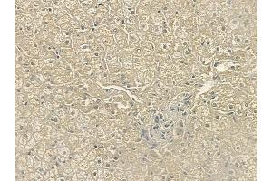 ABIN6259270 and ABIN6274431 at 1/100 staining human normal liver tissue by IHC-P. (PPHLN1 antibody  (N-Term))