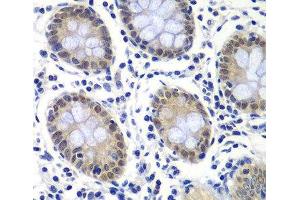 Immunohistochemistry of paraffin-embedded Human colon using GTF2F2 Polyclonal Antibody at dilution of 1:200 (40x lens). (GTF2F2 antibody)