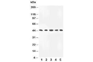 Western Blotting (WB) image for anti-Mitogen-Activated Protein Kinase Kinase 4 (MAP2K4) (C-Term) antibody (ABIN3031843)