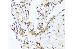 Immunohistochemistry of paraffin-embedded Human lung using BAG3 Polyclonal Antibody at dilution of 1:100 (40x lens). (BAG3 antibody)