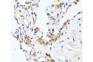 Immunohistochemistry of paraffin-embedded Human lung using BAG3 Polyclonal Antibody at dilution of 1:100 (40x lens).