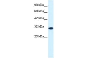 Western Blotting (WB) image for anti-Empty Spiracles Homeobox 2 (EMX2) antibody (ABIN2460259) (EMX2 antibody)
