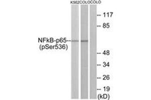 Western blot analysis of extracts from K562 cells and COLO cells, using NF-kappaB p65 (Phospho-Ser536) Antibody. (NF-kB p65 antibody  (pSer536))