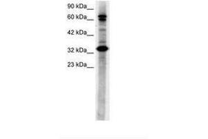 Image no. 3 for anti-TGF-beta Activated Kinase 1/MAP3K7 Binding Protein 2 (TAB2) (N-Term) antibody (ABIN6735781) (TAB2 antibody  (N-Term))