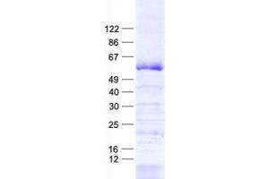ZNF35 Protein (His tag)