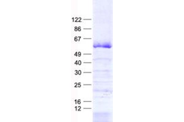 ZNF35 Protein (His tag)