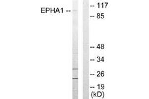 Western blot analysis of extracts from COLO205 cells, using EPHA1 Antibody. (EPHA1 antibody  (AA 541-590))