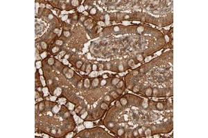 Immunohistochemical staining (Formalin-fixed paraffin-embedded sections) of human small intestine with RPS6KA6 polyclonal antibody  shows strong cytoplasmic and membranous positivity in glandular cells. (RPS6KA6 antibody)