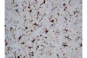 Image no. 1 for anti-Glial Fibrillary Acidic Protein (GFAP) (C-Term) antibody (ABIN1493067) (GFAP antibody  (C-Term))