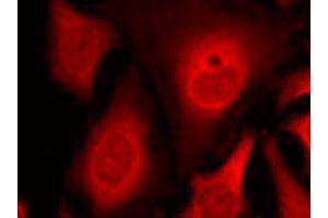 Immunofluorescence staining of methanol-fixed HeLa cells using EIF2S1 (phospho S49) polyclonal antibody (Cat # PAB25902, red). (EIF2S1 antibody  (pSer49))