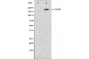 Western blot analysis on NIH-3T3 cell lysate using GANP Antibody,The lane on the left is treated with the antigen-specific peptide.
