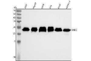 Western blot analysis of RAB5C/RABL using anti-RAB5C/RABL antibody (ABIN7606113).