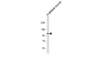 Anti-ATP1A2 Antibody (Center) at 1:2000 dilution + human skeletal muscle lysate Lysates/proteins at 20 μg per lane. (ATP1A2 antibody  (AA 451-479))