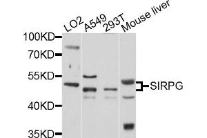 Western blot analysis of extracts of various cell lines, using SIRPG antibody (ABIN1876133) at 1:1000 dilution.